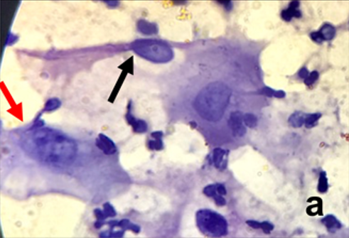 The Application of the Bethesda System for Reporting Cervical Cytology to Oral Cytology: An Institutional Study