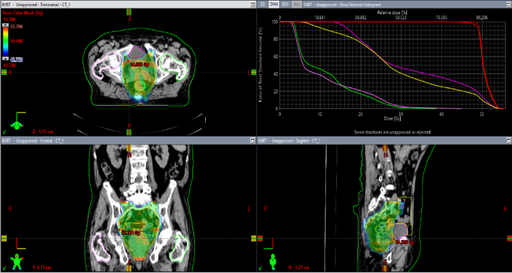 3D-CRT Versus SIB IMRT Acute Toxicity Outcomes in Preoperative Concurrent Chemo-Radiotherapy for Locally Advanced Rectal Cancer